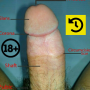 icon Penis Anatomy(Penis Anatomie
)