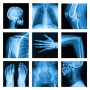 icon Medical X-Ray Interpretation(Medical X-Ray Interpretation with 100+ Cases
)
