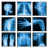 icon Medical X-Ray Interpretation(Medical X-Ray Interpretation with 100+ Cases
) 4.0.2